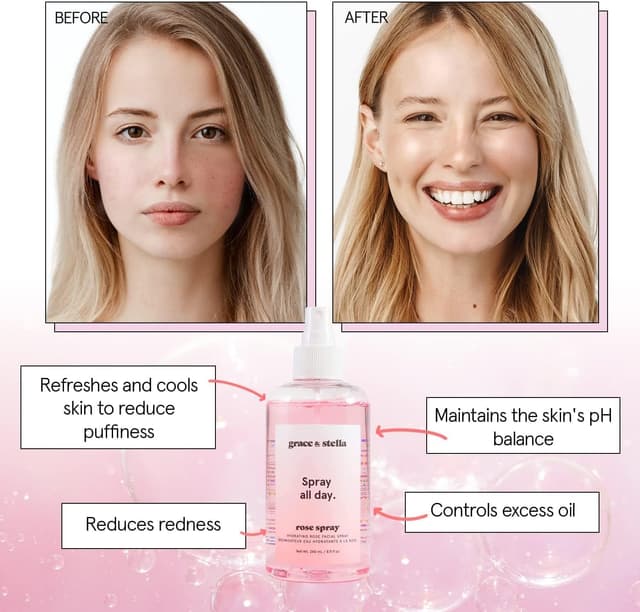 Detalle de Grace & Stella Award Winning Rose Water Facial Spray (240ml) — Vegan Rose Water Mist with Hyaluronic Acid