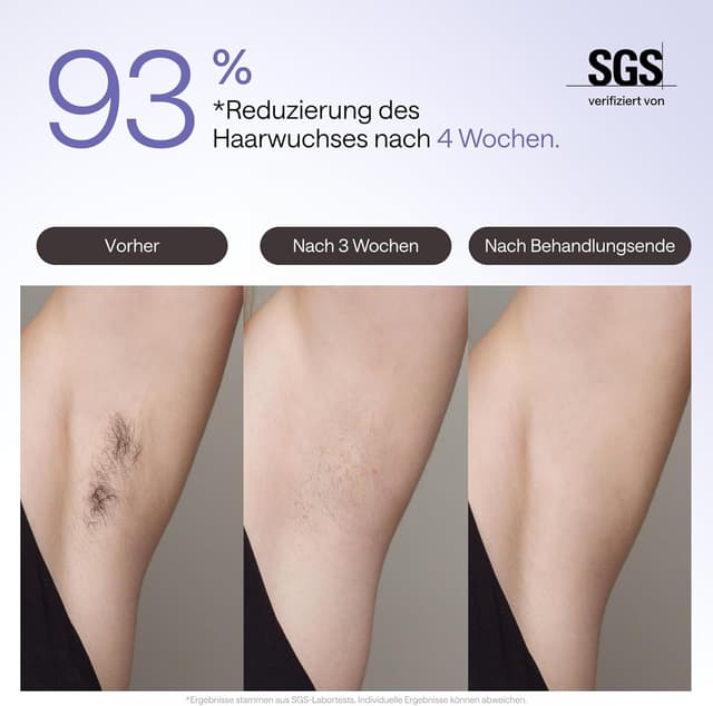 Thumbnail 2 de Ulike Air 3 IPL Haarentfernung