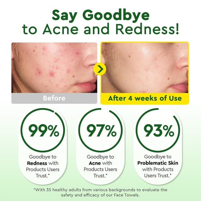 Detalle de Elvira 100 Count Disposable Face Towels — biogradable, ultra-soft makeup remover wipes for sensitive skin