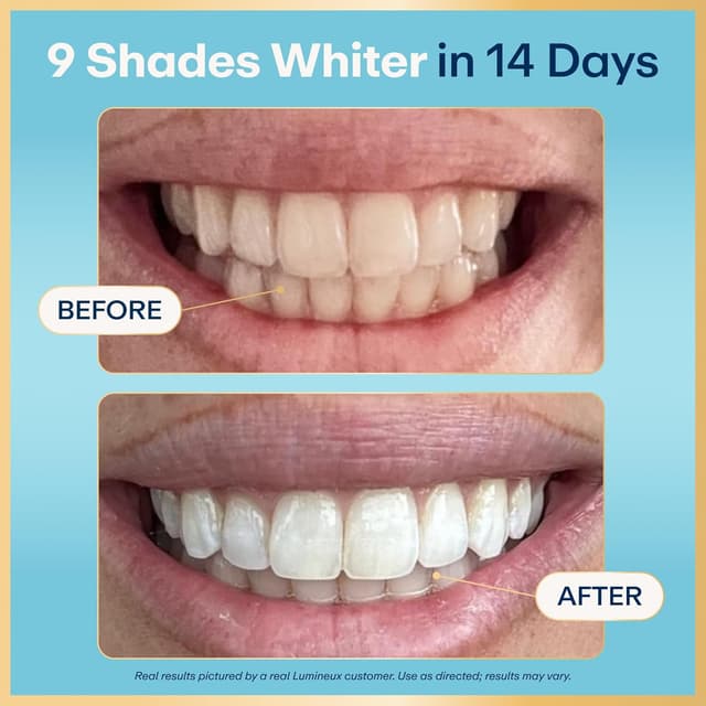 Detalle de Lumineux Whitening Strips Kit 9 Treatments