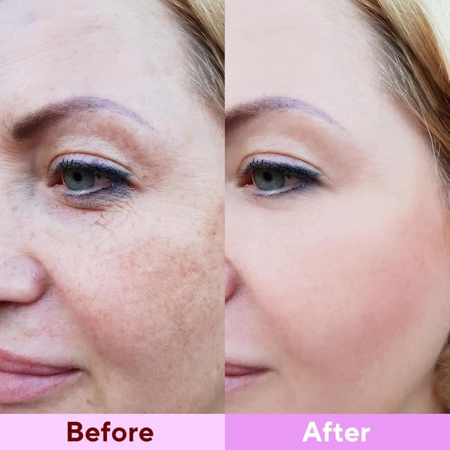 Thumbnail 6 de Nityrliv Collagen Face Mask (4-Pack) Bio-Collagen Deep Hydration Overnight Sheet Masks