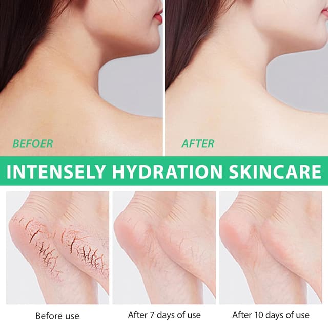 Thumbnail 4 de Crème à l'urée 40% pour pieds secs 100 g