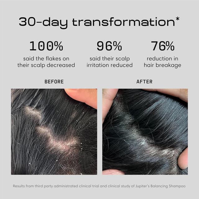 Thumbnail 3 de Jupiter Anti Dandruff 1% Zinc Pyrithione