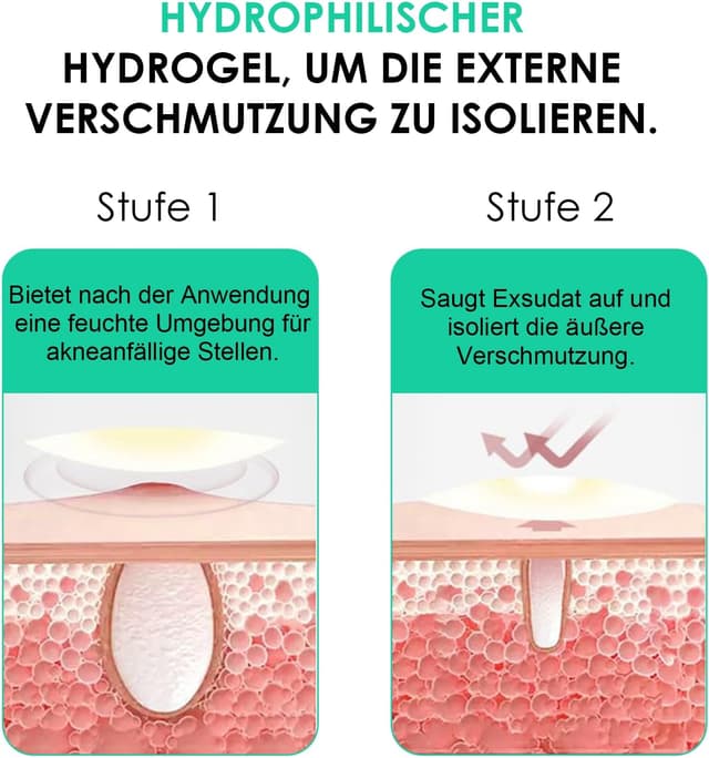 Detalle 1 de Home Holic patch brufoli 264 pezzi