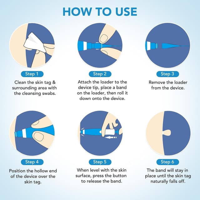 Thumbnail 3 de CFHQXSZ Skin Tag Removal Kit 40 Bands