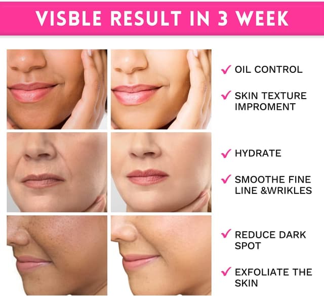 Detalle 2 de ANAi RUI Dischetti esfolianti all’acido glicolico 35% AHA Peeling Pad viso (80 pads)