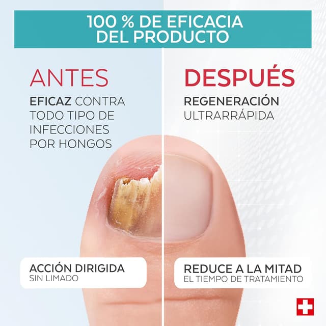 Detalle de PODERM 🦶 Tratamiento Hongo Uñas, 2 Piezas, Swiss Made