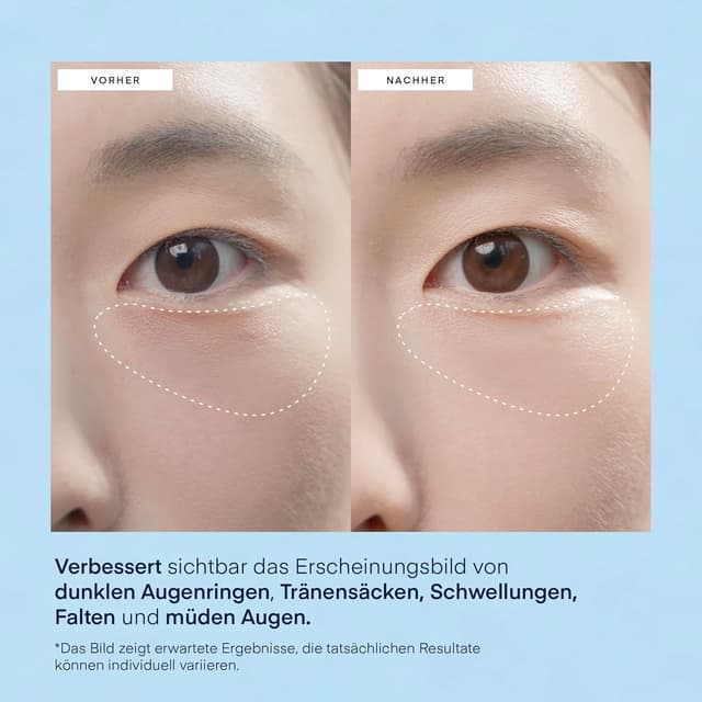 Detalle 2 de TEREZ & HONOR Augenpads gegen Augenringe