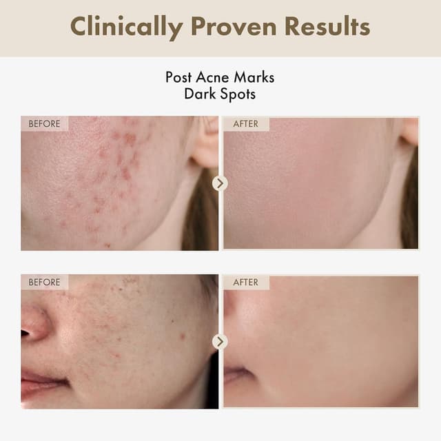 Detalle 2 de TOSOWOONG Siero all’Alfa Arbutina 2% con Acqua di Riso (33 ml) per uniformare l’incarnato