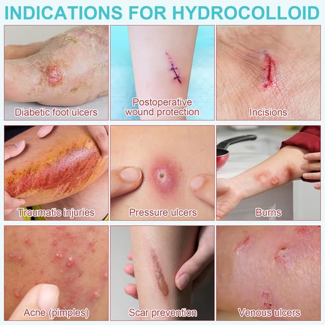 Thumbnail 6 de Hydrocolloid Roll Wundpflege 5 cm x 3,6 m