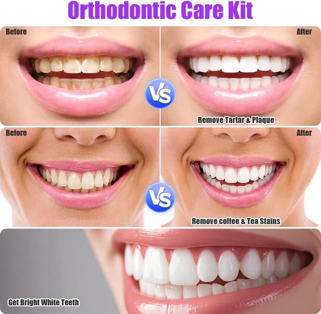 Thumbnail 5 de OFFCUP Kit Igiene Dentale 9 pezzi 🪥