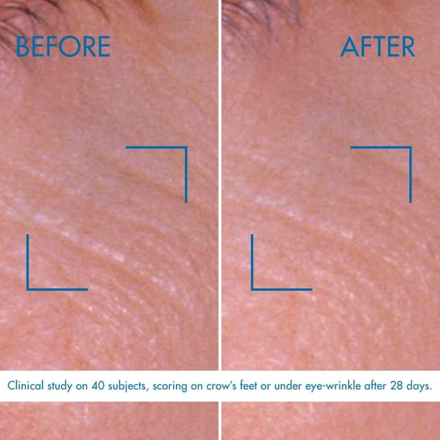 Thumbnail 3 de Biotherm Blue Pro-Retinol Eye Cream 0.5 fl oz 🧴