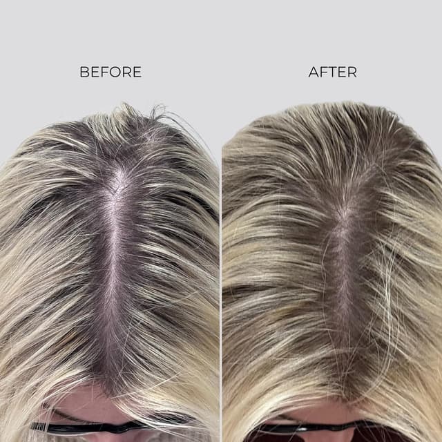 Thumbnail 6 de Nanogen Hair Growth Factor Treatment – sérum pour la pousse des cheveux à l’extrait de pea sprout, écorce et peptides (30 ml)