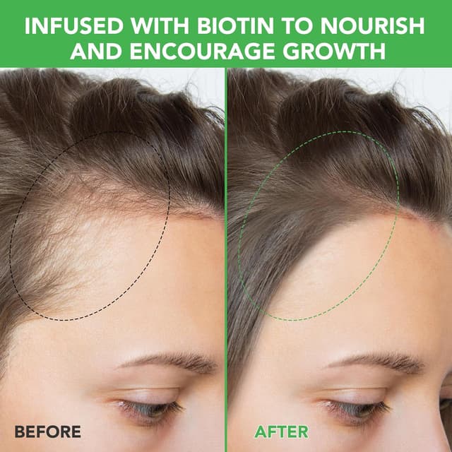 Detalle 2 de Shampoo al rosmarino anticaduta 10 fl oz