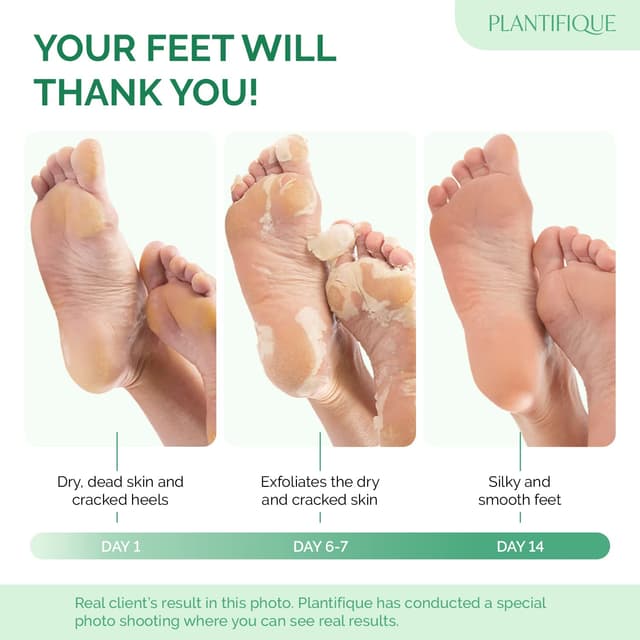 Detalle 2 de PLANTIFIQUE Foot Peeling Mask 4-Pack — Dermatologist-Tested Exfoliating Foot Peel Masks for Soft, Smooth Heels