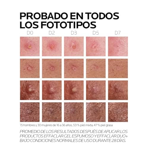 Thumbnail 7 de La Roche-Posay Effaclar Duo+M 40 ml