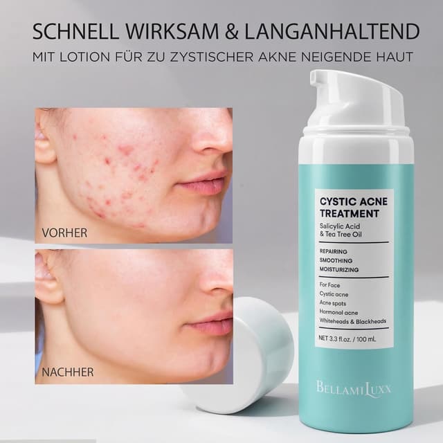 Thumbnail 2 de BellamiLuxx Akne Creme Hautpflege