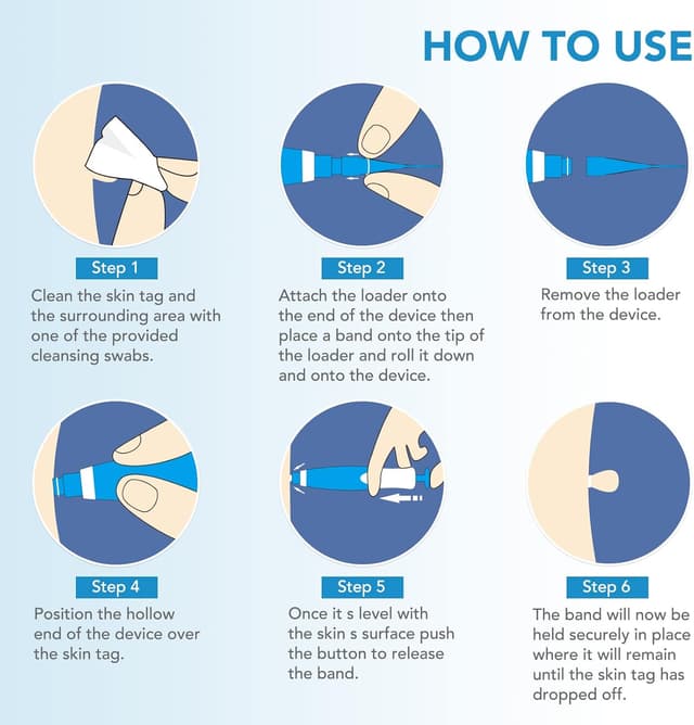 Thumbnail 4 de Skin Tag Removal Kit 40 bands 🩺