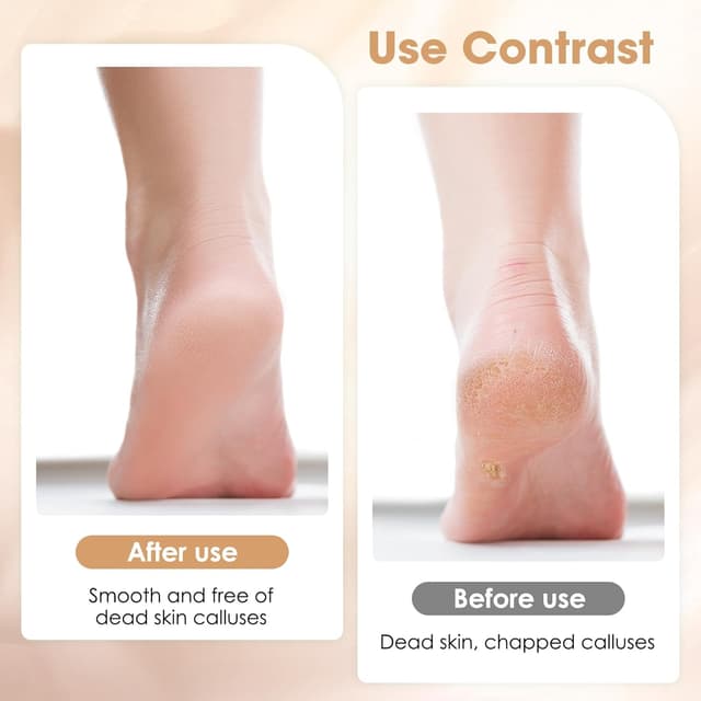 Thumbnail 3 de Kasoud Pumice Stone for Feet 3-Pcs