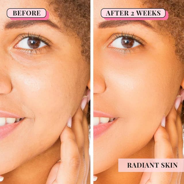 Detalle de ANAiRUi Rosen Tonerde Gesichtsmaske mit Rosen, Kaolin, Kollagen – 120 g