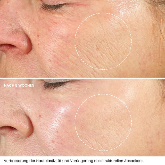 Detalle 2 de Bio-Nacht Feuchtigkeitsspendende Gesichtscreme 50ml