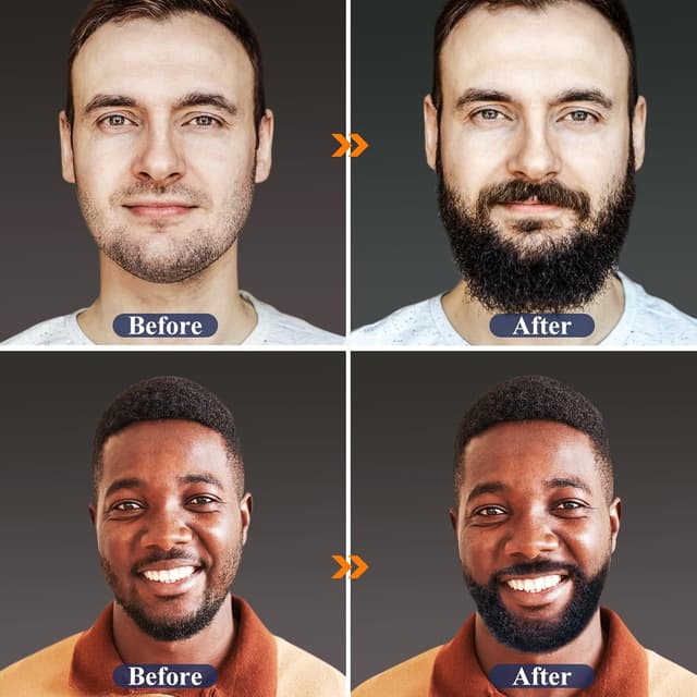 Thumbnail 3 de MALE GOD Beard Growth Kit 🧔