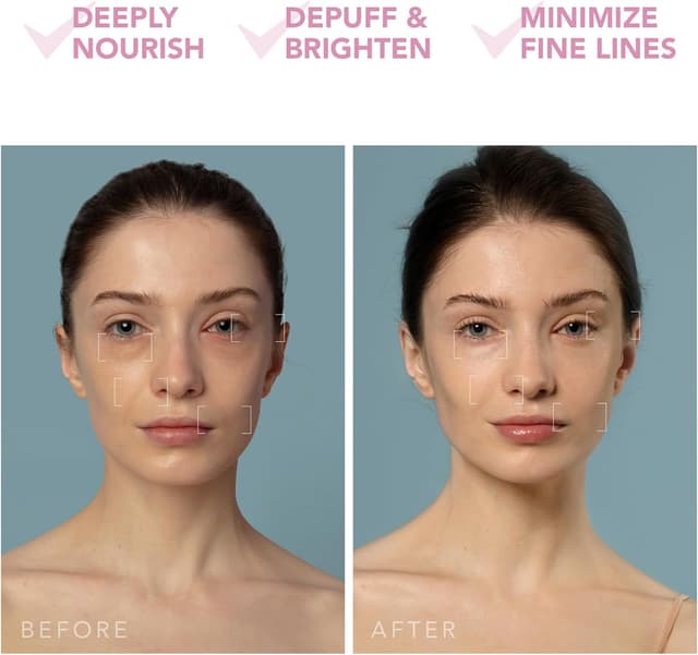 Thumbnail 4 de UFO 3 dispositivo viso anti-age 5 in 1