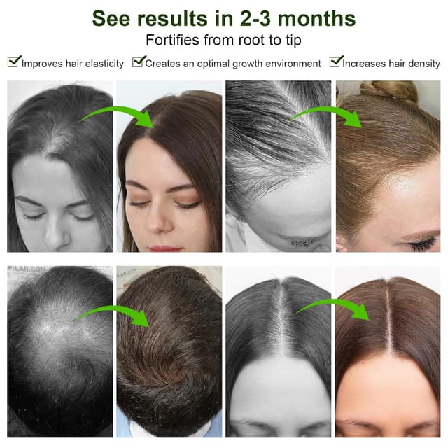 Thumbnail 5 de Haarwachstum Serum Spray mit Rosmarinöl