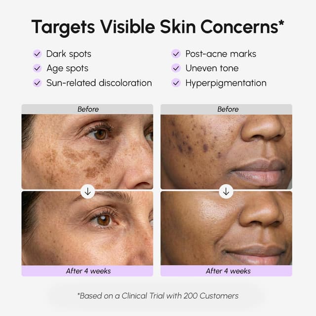 Detalle de MAREE Dark Spot Remover Serum for Face & Body (TXA, Vitamin C & Niacinamide) — Fade Black & Brown Spots