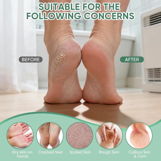 Detalle de Crema Urea 50% per piedi, mani e zone ruvide con acido salicilico 2% (max 150 g) con cocco, acido ialuronico, tea tree e aloe vera