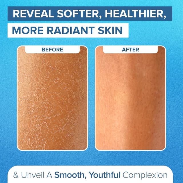 Detalle de DEEP Exfoliation Body Exfoliator Mitt for Dead Skin Removal (1 Glove) – washable exfoliating glove