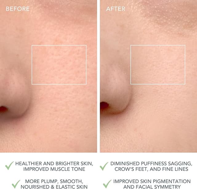 Detalle 1 de FOREO LUNA 4 Cepillo limpieza facial para piel mixta