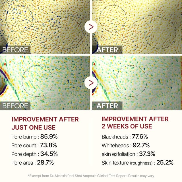 Thumbnail 5 de DR.MELAXIN Peel Shot Glow Ampoule 80ml