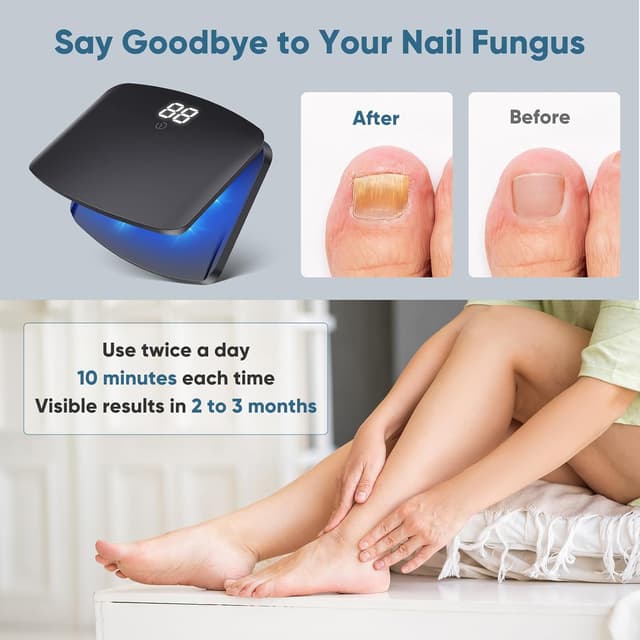 Thumbnail 4 de Nagelpilz Lasergerät 15 LEDs