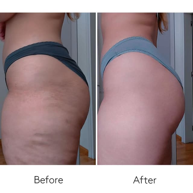 Thumbnail 4 de Body Power Smart Burn Anti-Cellulite 150 ml