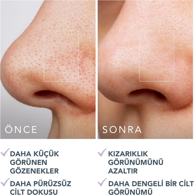 Thumbnail 4 de FOREO KIWI Disques réducteurs de pores 60 pc