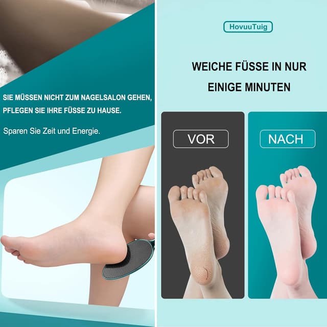 Detalle de HovuuTuig Nano Glas Hornhautentferner 9,44 x 2,64 in 🦶