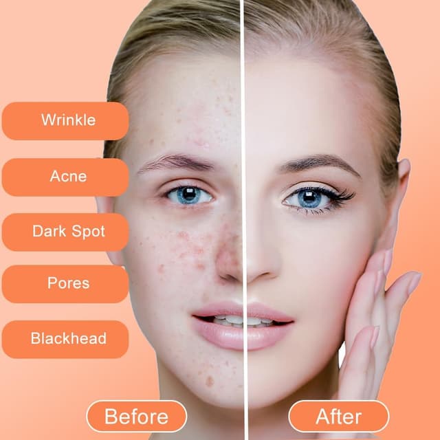 Detalle de Sapone all’Acido Cogico con Curcuma e Glutatione (2 pezzi da 65 g) per viso e corpo