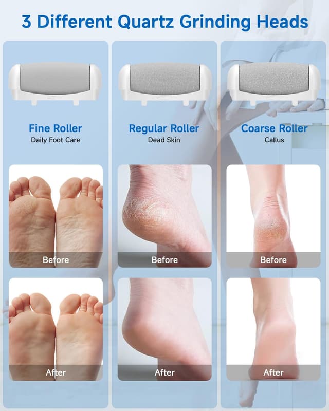 Detalle de Banral elektrischer Hornhautentferner 3 Gänge