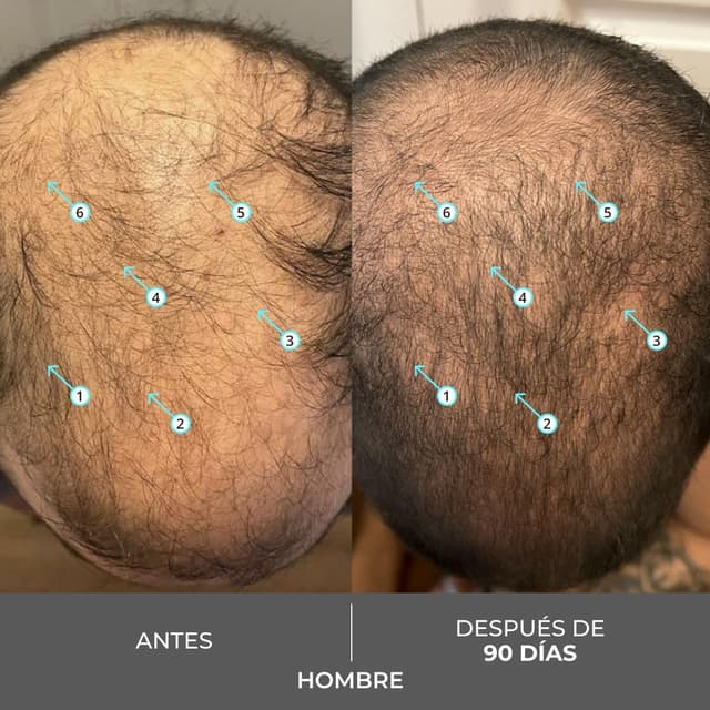 Thumbnail 4 de DS Laboratories Revita Extra Strength 205 ml