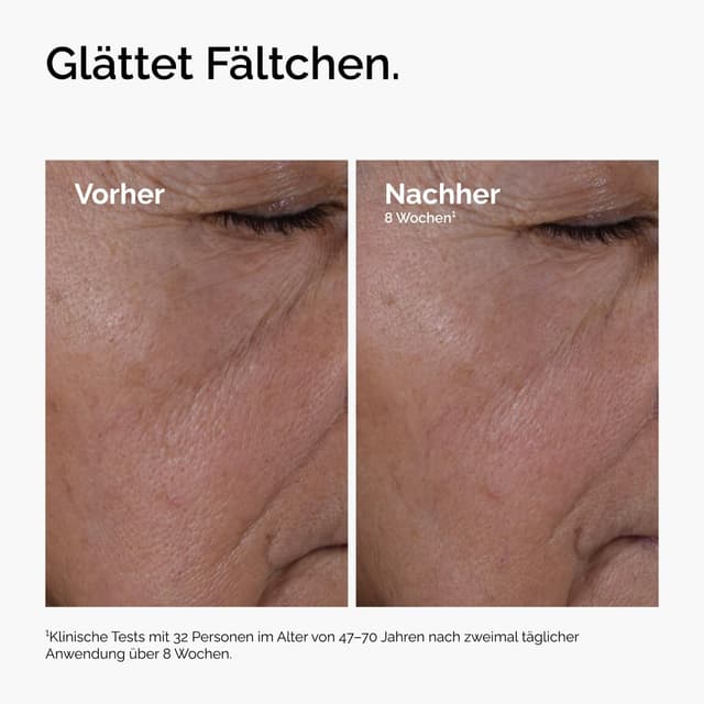 Detalle 2 de The Ordinary Multi-Peptide + HA Serum (30 ml) – Anti-Aging-Serum gegen Krähenfüße