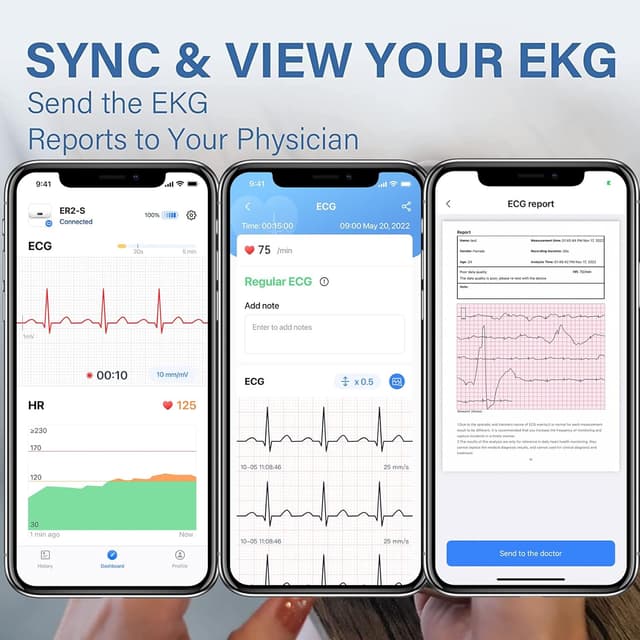 Detalle 2 de CheckMe DuoEK-S home ECG monitor with Bluetooth and OLED screen