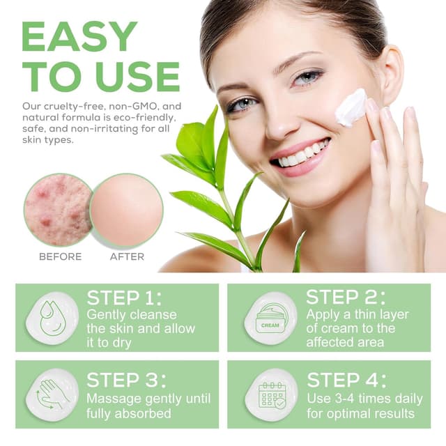 Thumbnail 5 de Urea Creme 40 Prozent für trockene Haut – Hände, Füße, Ellbogen