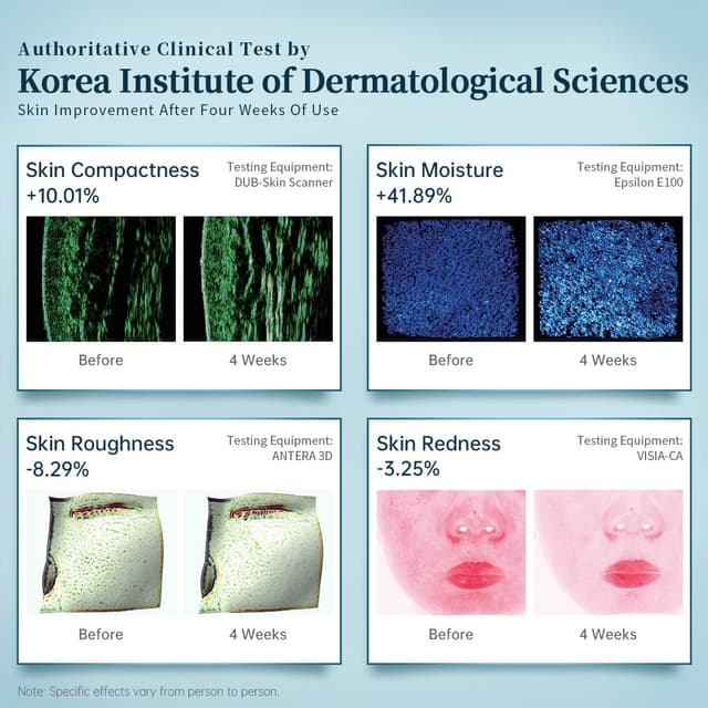 Thumbnail 5 de GYH 8-Color LED Face Mask 5-10 min