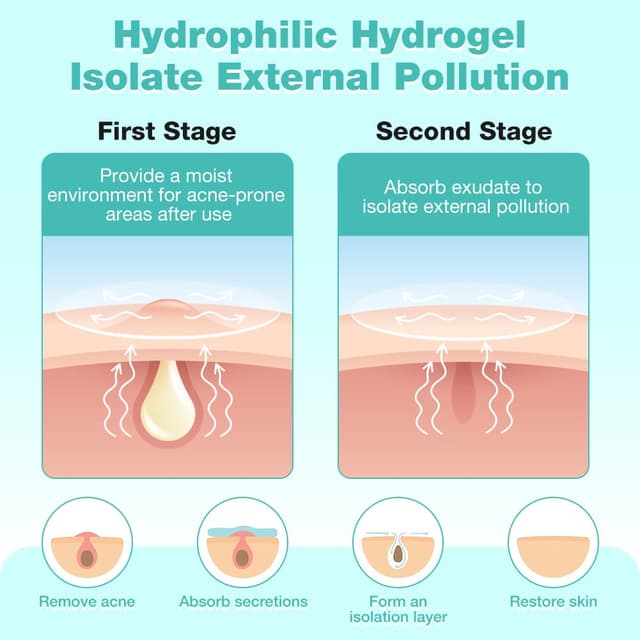 Detalle de BUTBU 400 Stück sternförmige Hydrocolloid-Pimple-Patches (Tag & Nacht, 2-in-1) mit Teebaumöl & Centella