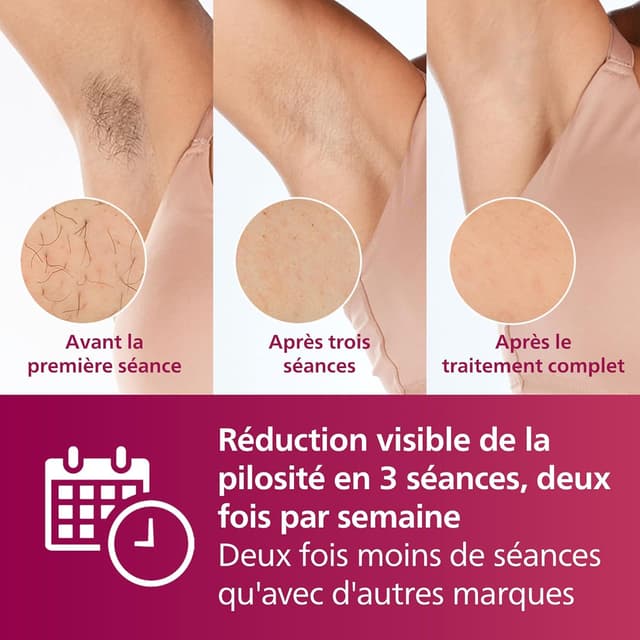 Thumbnail 3 de Philips Lumea série 7000 épilateur IPL 💁♀