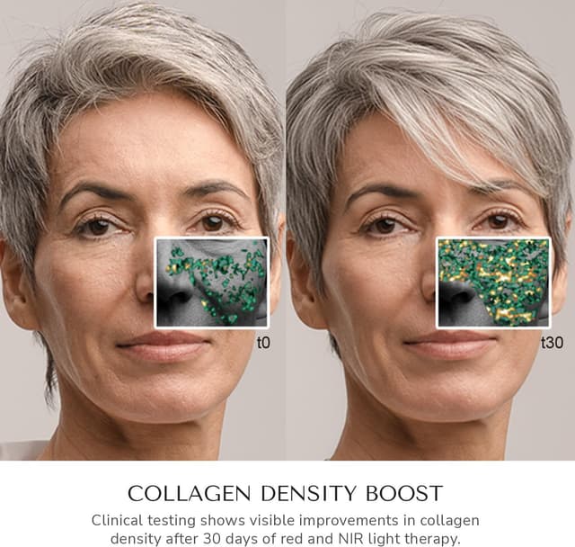 Thumbnail 2 de ODELYNE Adara masque facial 288 LED 🧖