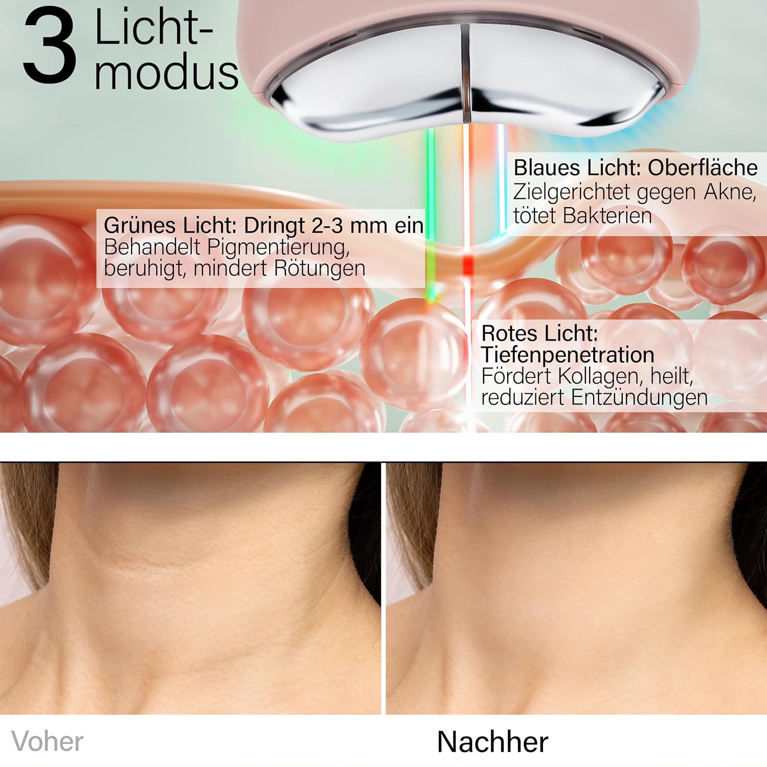 Thumbnail 2 de Rosental Organics EMS Gua Sha Gesichtsmassagegerät