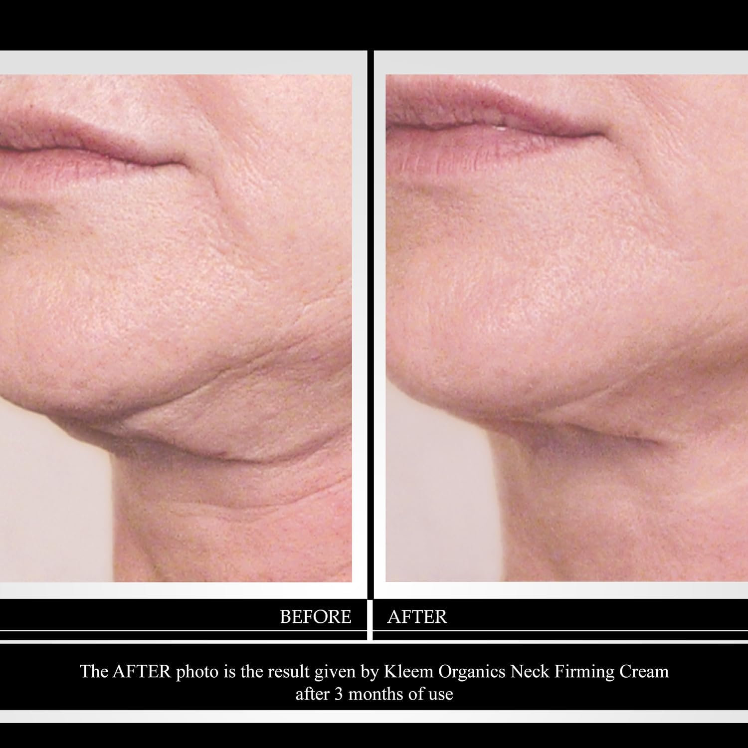 Thumbnail 1 de Crème raffermissante pour le cou et le décolleté au panthénol et au rétinol – soin anti-âge 50 ml