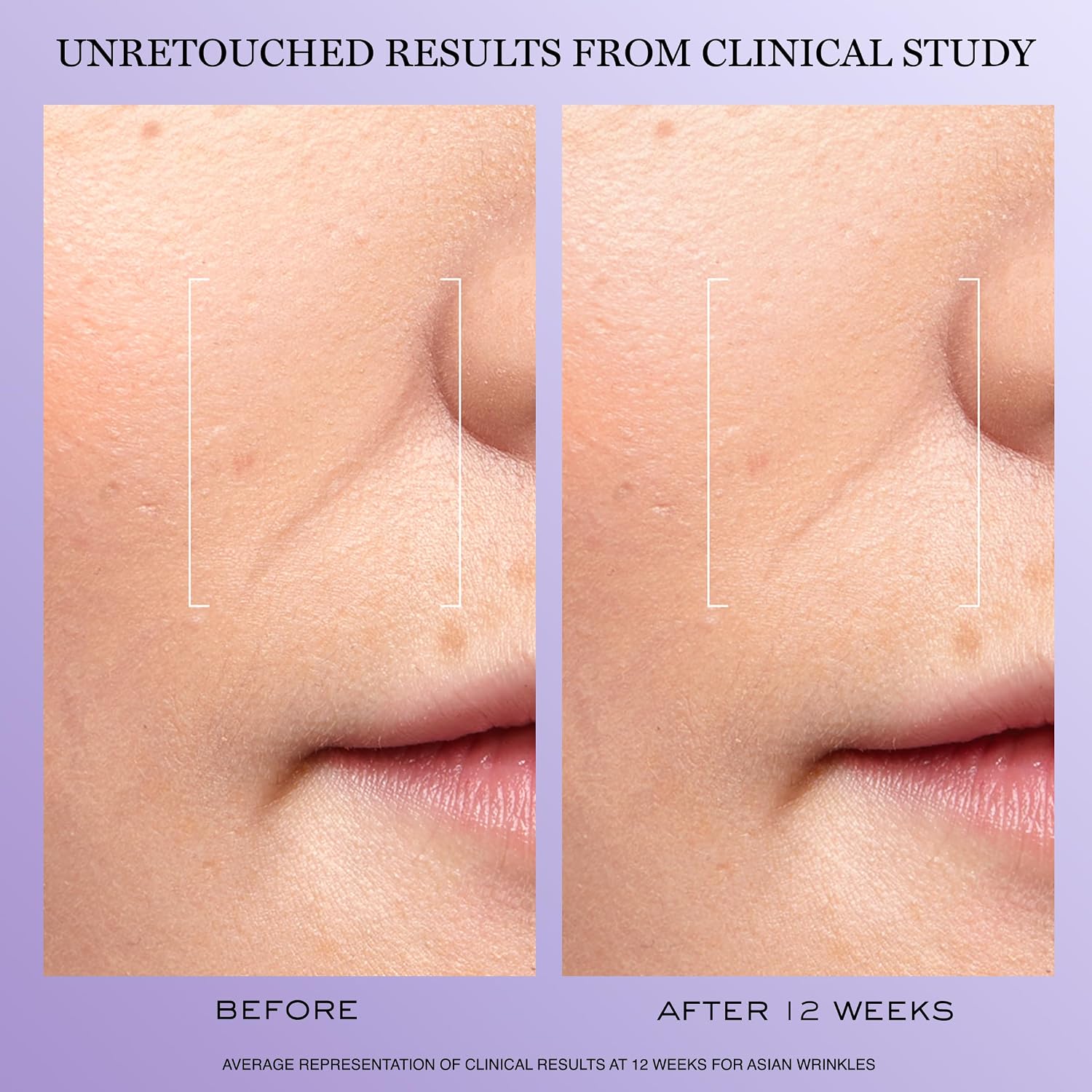 Detalle de Lancôme Rénergie H.C.F. Triple Serum 3614272860377, Face Serum with Hyaluronic Acid
